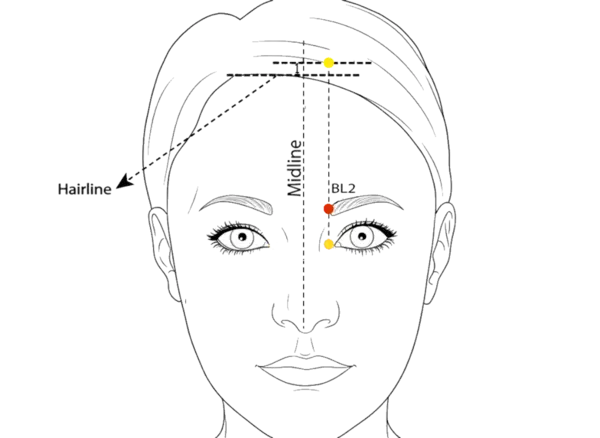 BL-2 - Gathered Bamboo Acupoint Location illustration for On the face, at the medial extremity of the eyebrow, in the supraorbital notch.