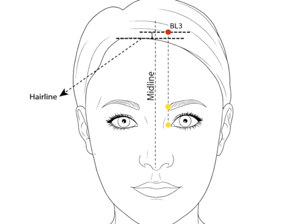 BL-3 - Eyebrows Pouring Acupoint Location illustration for 0.5 cun directly above the midpoint of the eyebrow, within the anterior hairline, and 0.5 cun lateral to the midline.