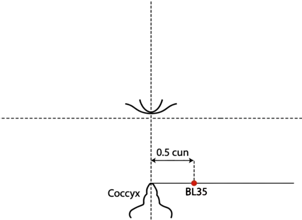 Location illustration for 0.5 cun lateral to the tip of the coccyx.