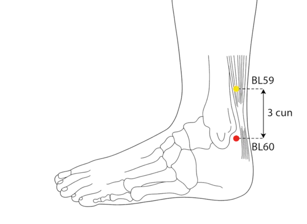 Location illustration for In the depression between the lateral malleolus and the Achilles tendon.