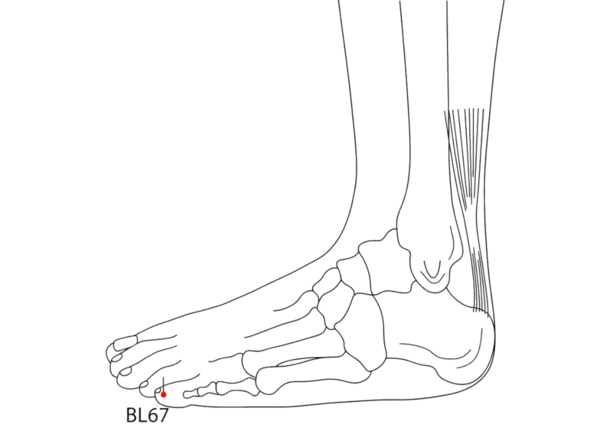 Location illustration for On the lateral side of the small toe, approximately 0.1 cun from the corner of the nail.
