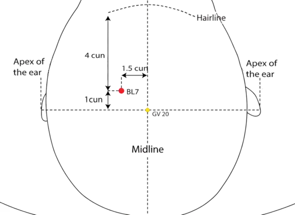 Location illustration for 4 cun posterior to the anterior hairline and 1.5 cun lateral to the midline, directly above BL-6.