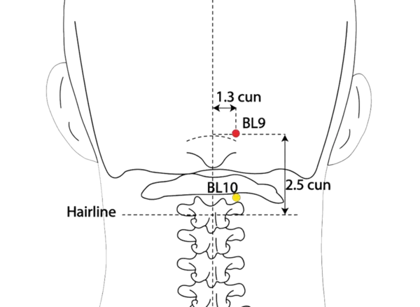 Location illustration for 2.5 cun directly above the posterior hairline and 1.3 cun lateral to the midline, in the depression on the lateral aspect of the superior nuchal line.