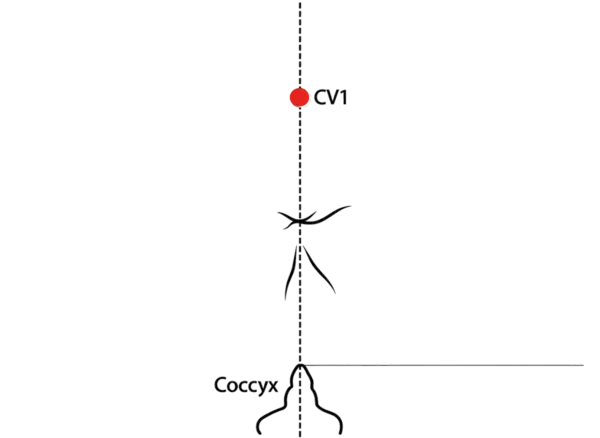 CV-1 - Meeting of Yin Acupoint Location illustration for At the midpoint between the anus and the posterior border of the scrotum (in males) or the posterior labial commissure (in females).