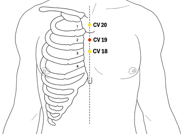 CV-19 - Purple Palace Acupoint Location illustration for On the anterior midline of the chest, at the level of the second intercostal space.