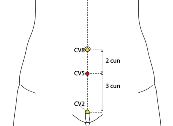 CV-5 - Stone Gate Acupoint Location illustration for On the midline of the lower abdomen, 2 cun below the umbilicus.