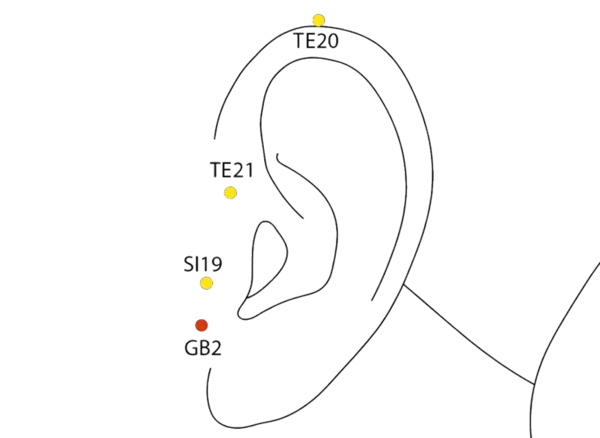 Location illustration for In the depression anterior to the ear, just in front of the tragus.