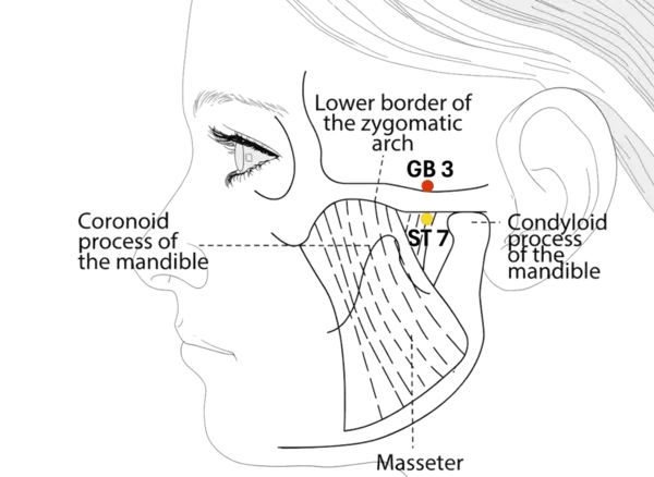 Location illustration for At the upper border of the zygomatic arch, in the depression anterior to the ear.