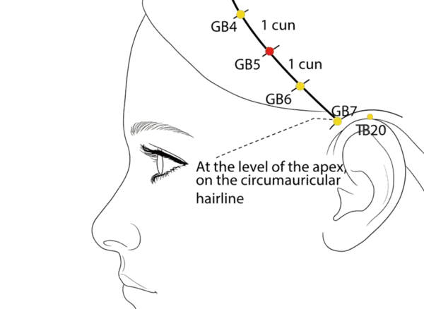 Location illustration for On the temporal side of the head, equidistant between GB-4 and GB-6.