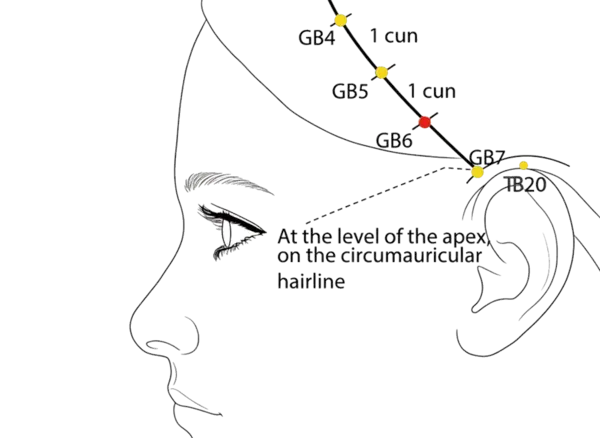 GB-6 - Suspended Hair Acupoint Location illustration for On the temporal side of the head, in the depression posterior to GB-5.