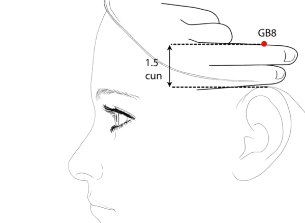 Location illustration for Directly above the ear apex, in the depression within the hairline.