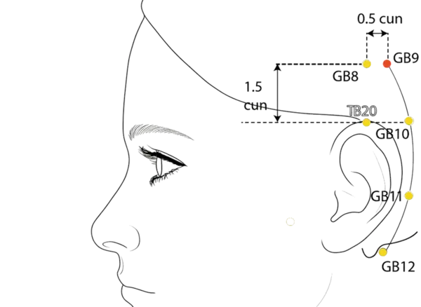 GB-9 - Celestial Rushing Acupoint Location illustration for In the temporal region, posterior to GB-8, within the hairline.