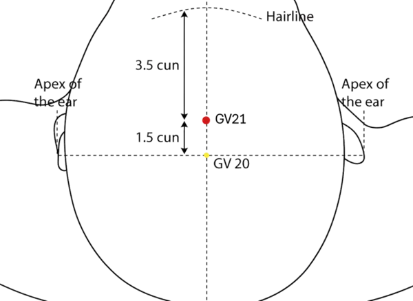 Location illustration for On the midline of the scalp, 1.5 cun anterior to Baihui (GV-20).