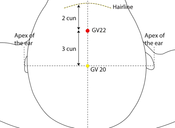 GV-22 - Fontanelle Meeting Acupoint Location illustration for On the midline of the scalp, in the region of the anterior fontanel.