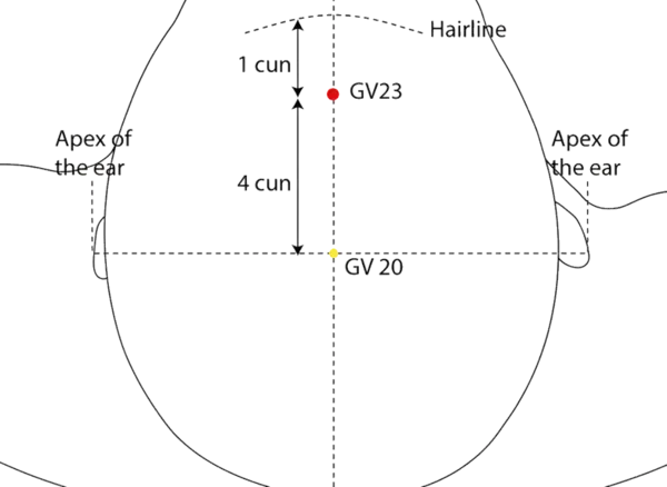 GV-23 - Upper Star Acupoint Location illustration for On the midline of the scalp, 1 cun posterior to the anterior hairline.