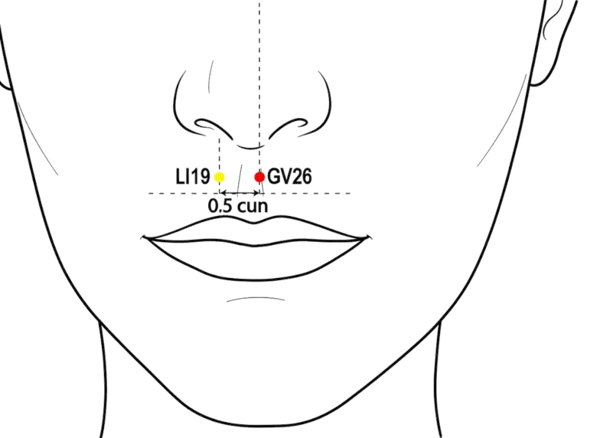 GV-26 - Man's Middle Acupoint Location illustration for On the midline, between the nose and upper lip, in the philtrum groove.