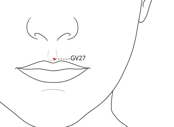 Location illustration for Just superior to the vermilion border of the upper lip, on the midline.