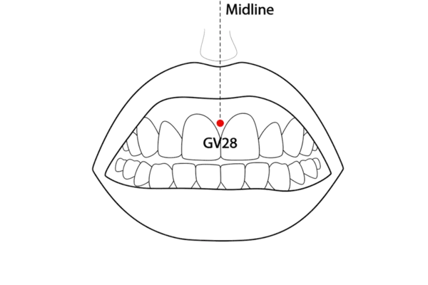 Location illustration for On the midline, where the frenulum of the upper lip meets the gingiva.