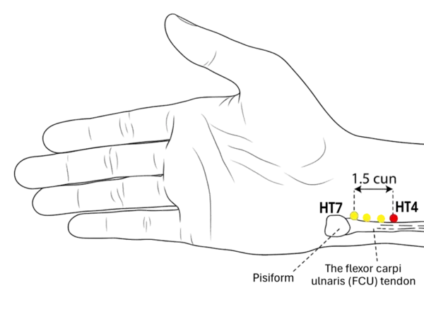 Location illustration for On the radial side of the tendon of flexor carpi ulnaris, 1.5 cun above the transverse wrist crease.