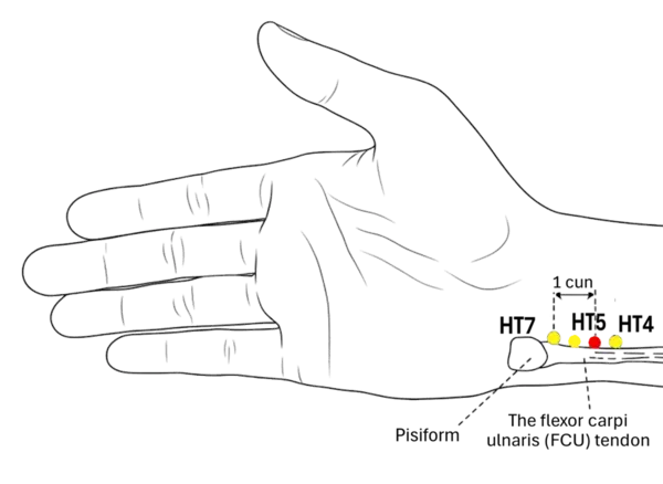 Location illustration for On the radial side of the tendon of flexor carpi ulnaris, 1 cun above the transverse wrist crease.