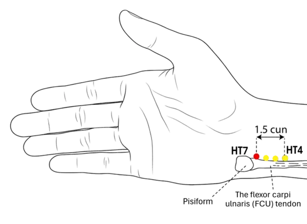 Location illustration for On the wrist crease, at the radial side of the tendon of flexor carpi ulnaris.