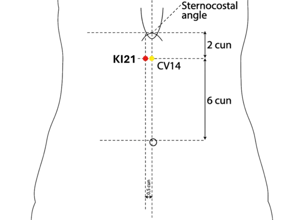 KI-21 - Dark Gate Acupoint Location illustration for On the upper abdomen, level with CV-14.