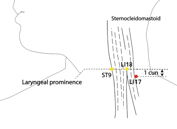 Location illustration for Located on the neck, just below LI-18, near the SCM.