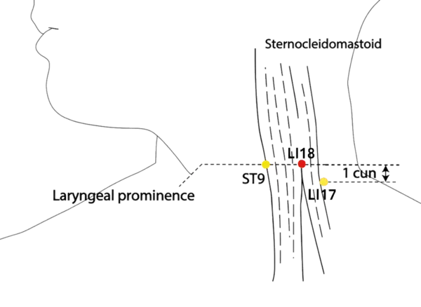 LI-18 - Support the Prominence Acupoint Location illustration for Located at the level of the larynx, in a depression between the two heads of the SCM.