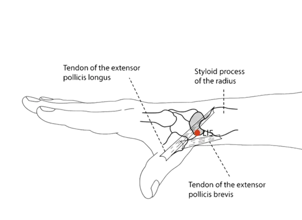 LI-5 - Yang Stream Acupoint Location illustration for Located on the wrist crease, lateral to the radial styloid process.