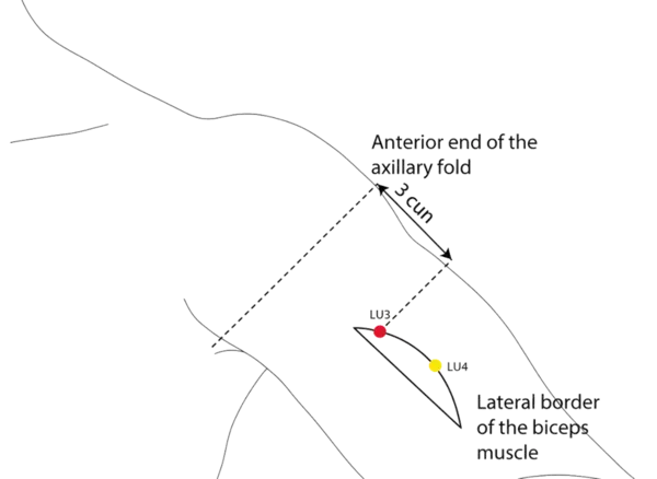 Location illustration for Located on the upper arm, lateral to the biceps muscle.