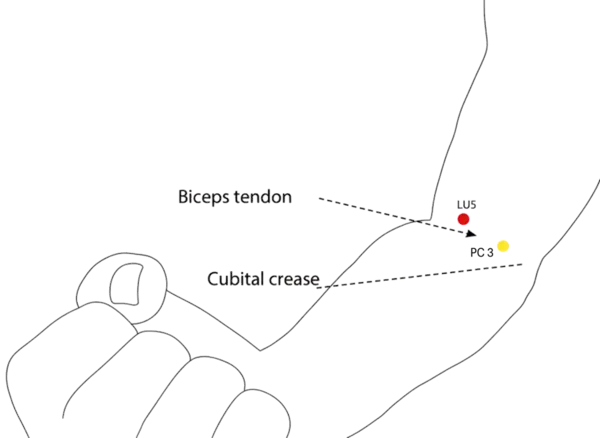 LU-5 - Cubit Marsh Acupoint Location illustration for Located at the elbow crease, lateral to the tendon of biceps brachii.