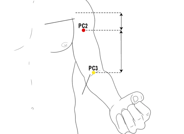 PC-2 - Celestial Spring Acupoint Location illustration for Located on the upper arm, in the groove between the biceps muscles.