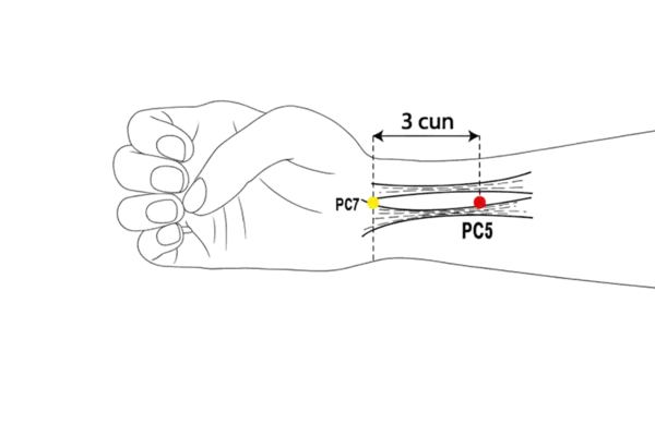 PC-5 - Intermediate Messenger Acupoint Location illustration for Located on the anterior forearm, midway between PC-4 and PC-6.