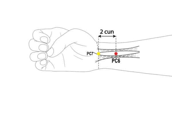 PC-6 - Inner Pass Acupoint Location illustration for Located on the anterior forearm, just above the wrist.