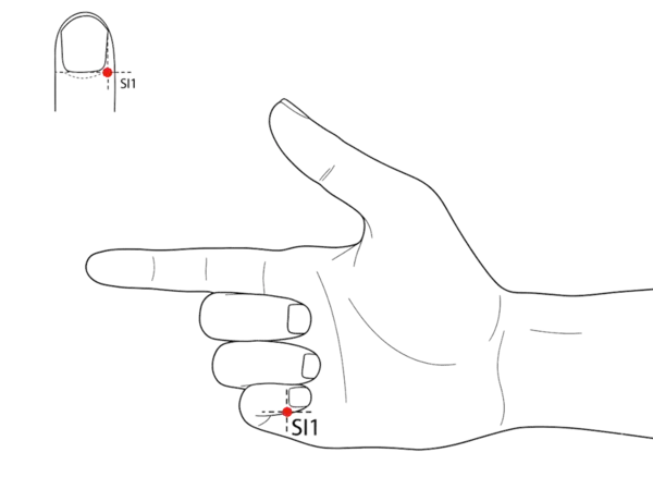SI-1 - Lesser Marsh Acupoint Location illustration for At the junction of lines drawn along the ulnar border and base of the nail of the little finger.