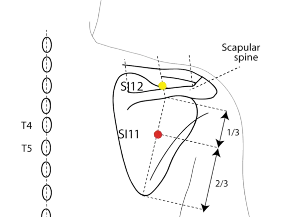 Location illustration for Located by drawing a line from the midpoint of the scapular spine to the inferior angle.