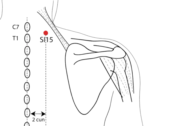 Location illustration for Located on the posterior neck, lateral to the spine at the level of the seventh cervical vertebra.