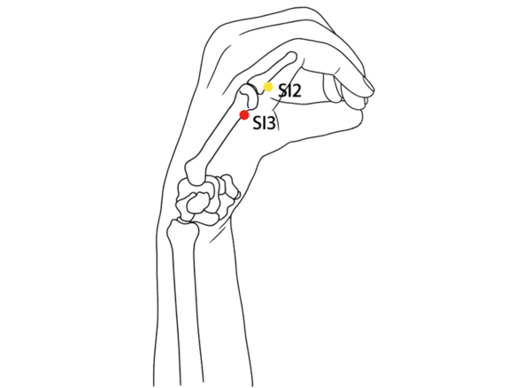 Location illustration for In the depression at the junction of red and white skin, just proximal to the fifth metacarpophalangeal joint.