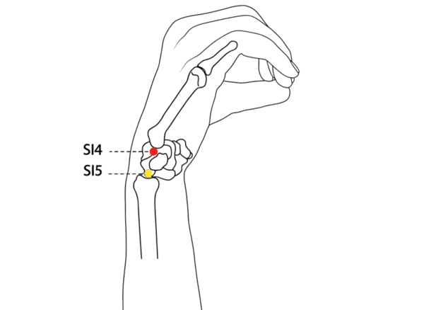 SI-4 - Wrist Bone Acupoint Location illustration for In a palpable hollow on the medial wrist, just distal to the wrist crease.