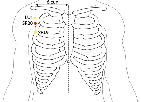 Location illustration for On the chest, in the 2nd intercostal space, lateral to the nipple line.