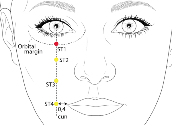 ST-1 - Container of Tears Acupoint Location illustration for Directly below the pupil, between the eyeball and the infraorbital ridge, in the infraorbital foramen area.