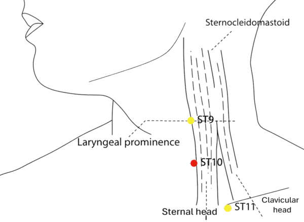 ST-10 - Water Prominence Acupoint Location illustration for On the anterior border of the sternocleidomastoid muscle, midway between ST-9 (Renying) and ST-11 (Qishe), level with the laryngeal prominence.