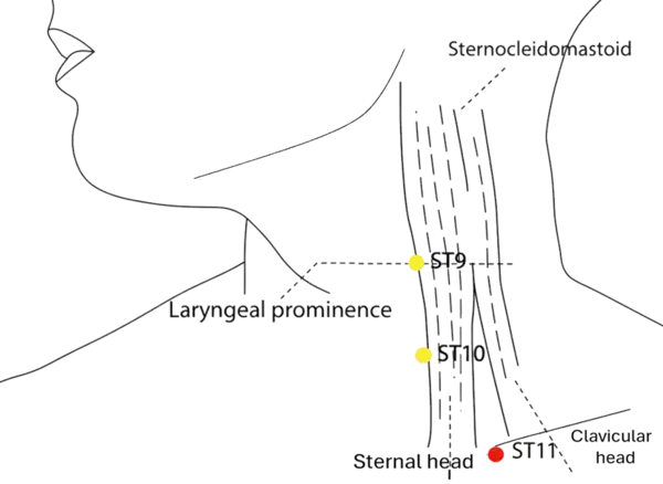 ST-11 - Qi Abode Acupoint Location illustration for At the superior border of the medial end of the clavicle, in the depression between the sternal and clavicular heads of the sternocleidomastoid muscle.
