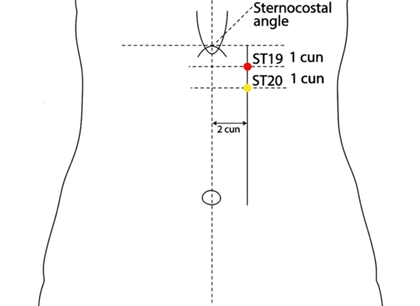 ST-19 - Not Contained Acupoint Location illustration for On the upper abdomen, 6 cun above the umbilicus and 2 cun lateral to the anterior midline, level with CV-14.
