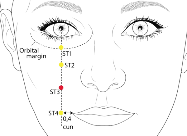 ST-3 - Great Crevice Acupoint Location illustration for Directly below the pupil, level with the lower border of the ala nasi, on the lateral side of the nasolabial groove.