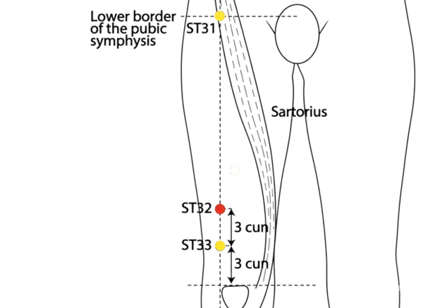 ST-32 - Crouching Rabbit Acupoint Location illustration for In the depression between the rectus femoris and vastus lateralis muscles.