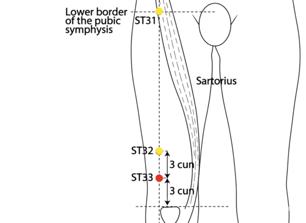 ST-33 - Yin Market Acupoint Location illustration for Between the rectus femoris and vastus lateralis muscles, often tender on palpation in cases of lower limb dysfunction.