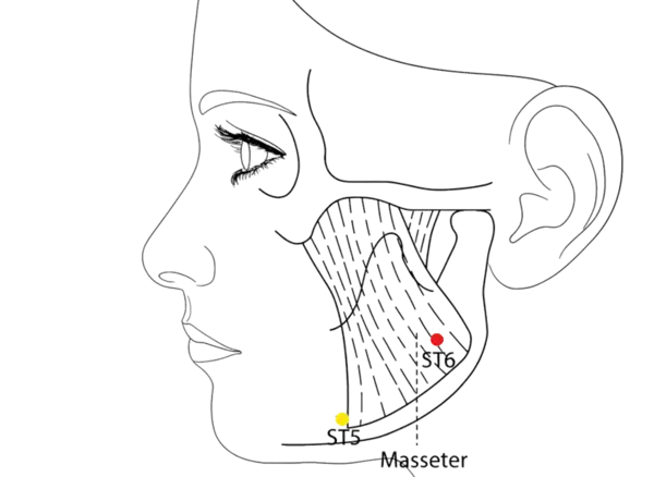 ST-6 - Jaw Bone Acupoint Location illustration for Approximately one finger-breadth anterior and superior to the angle of the mandible, in the belly of the masseter muscle when teeth are clenched.