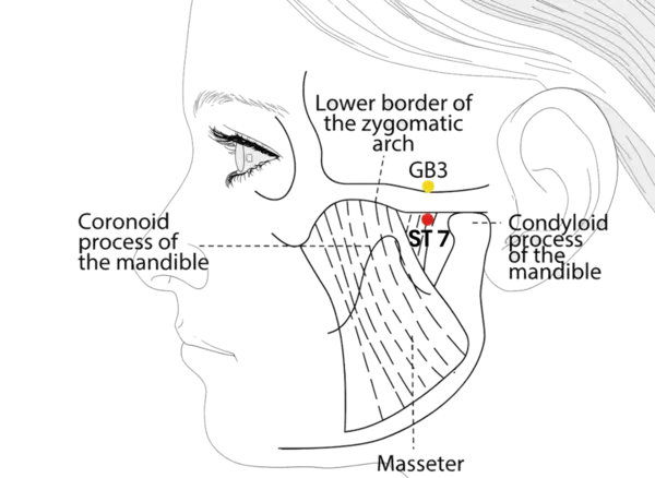 ST-7 - Below the Joint Acupoint Location illustration for In the depression anterior to the condyloid process of the mandible, with the mouth slightly open, at the lower border of the zygomatic arch.