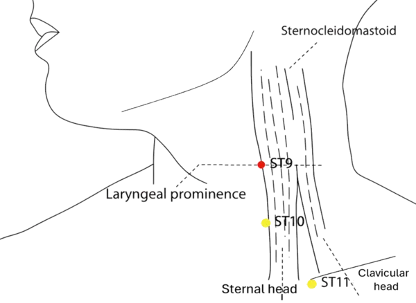 ST-9 - Man's Welcome Acupoint Location illustration for Level with the tip of the Adam's apple, on the anterior border of the sternocleidomastoid muscle, where the carotid artery pulsates.